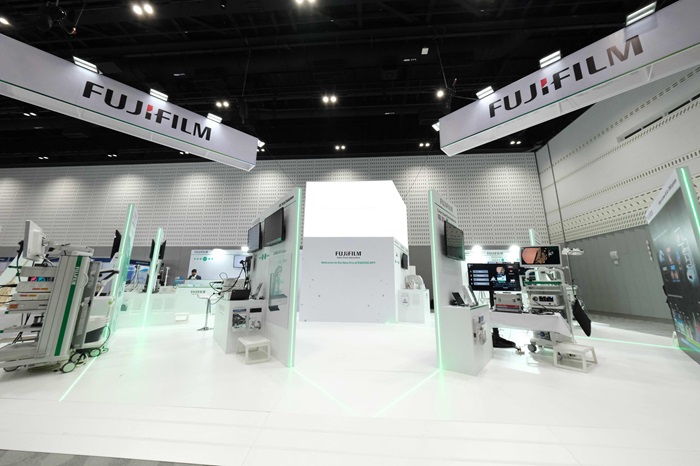 ฟูจิฟิล์ม โชว์ "CAD EYE" นวัตกรรม AI ตรวจหาความผิดปกติในระบบทางเดินอาหาร