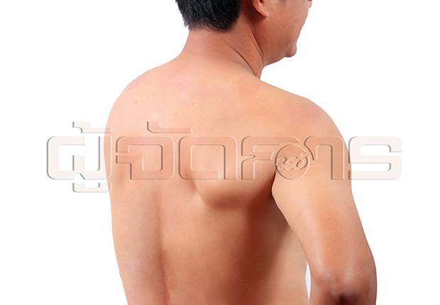บอกลาอาการปวดหลัง ... ไม่ยาก