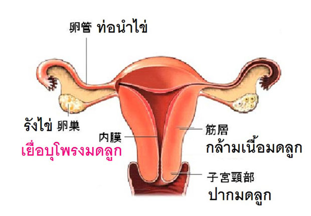 เท่าทันมะเร็งเยื่อบุโพรงมดลูก
